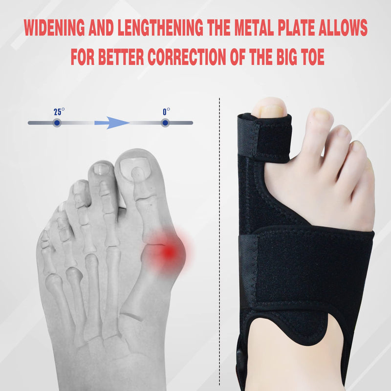 [Australia] - 1 Pair Bunion Corrector for Women & Men, Night Bunion Splint, Big Toe Straightener, Bunion Brace for Pain Relief Black One Size 
