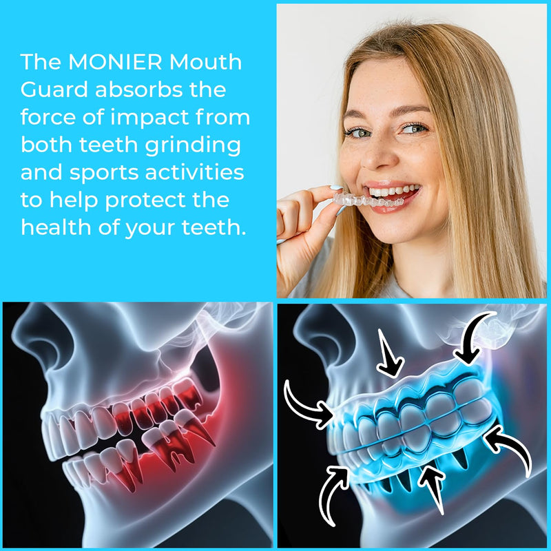 [Australia] - Mouth Guard for Grinding Teeth at Night | Dental Night Guard for Clenching & Better Sleep | 4 Moldable Mouthguards with 12 Cleansing Tablets 