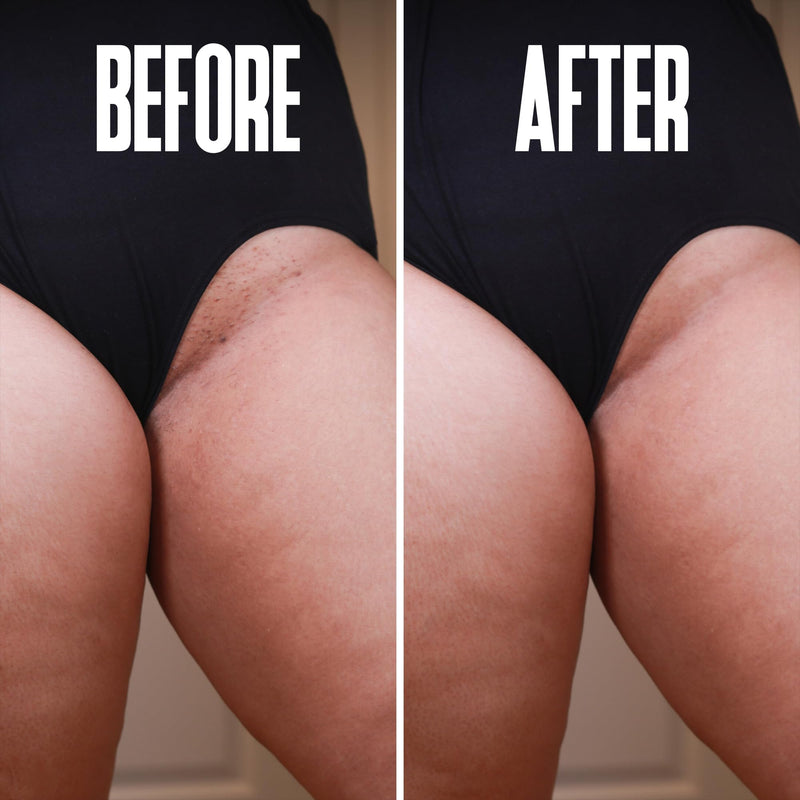 [Australia] - Prevent Ingrown Hairs and Razor Bumps with BHA & AHA Pads - Ingrown Hair Serum for Razor Burns, PFB Razor Bump Stopper Topicals Skin Care, Ingrown Hair Treatment for Bikini Area and Razor Bumps 50pads 