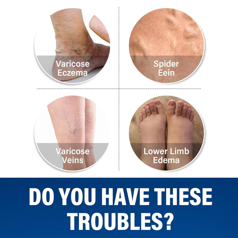 [Australia] - Grgowe Varicose Veins Cream, Varicose Veins Cream, Cream for Spider Veins, Active Veins, Anti-Varicose Veins Cream, Cream for Relieving and Preventing Varicose Veins, Improve Blood Circulation for Legs 