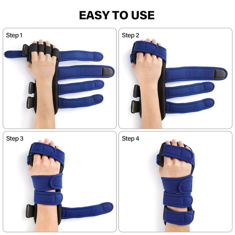 Resting Hand Splint, Functional Hand Brace, Wrist & Finger Night Immobilizer, Hand Support for Tendinitis, Arthritis, Carpal Tunnel Syndrome, Stroke Hand, Fit for Left and Right Hand L/XL