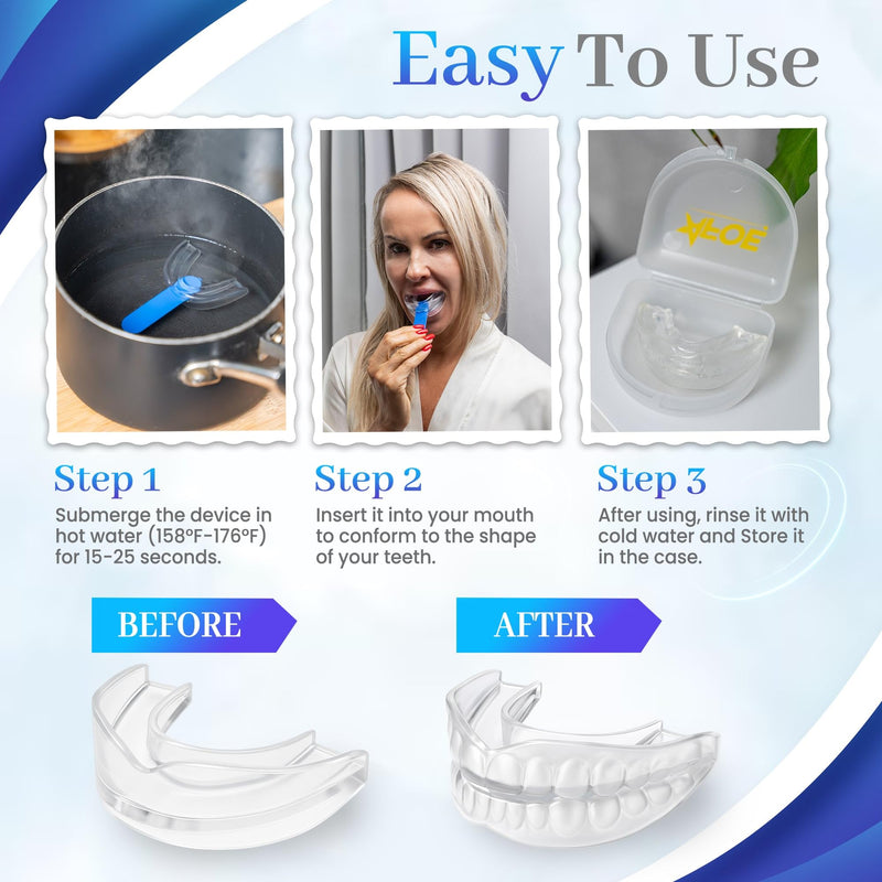 [Australia] - Bruxism Night Guard for Teeth Grinding & TMJ Relief, Premium Comfort Nose Breathing Oxygen Kit – 2-Pack (Clear & Blue), BPA & Latex-Free, Custom Dental Guards, Travel Cases & Brush – by AFOE 