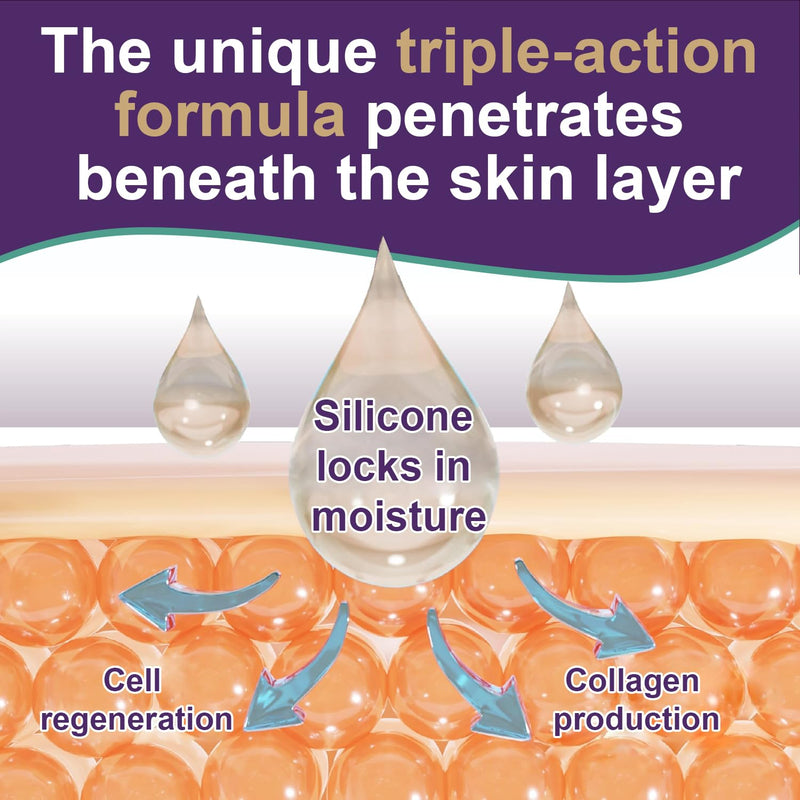 [Australia] - Silicone Scar Cream Scar Gel - Advanced Scar Gel Scar Treatment for Stretch Marks Removal, Old & New Scars, Surgical Scars, Burns, Acne, C-Section, Keloid Scar Treatment for Women & Men, 1.76Oz 