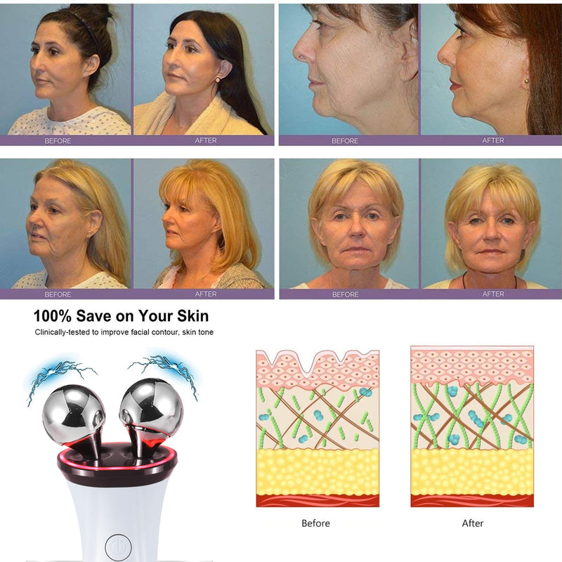 Microcurrent Facial Device - Electric Face Lifting & Toning for Face & Neck for Mother & Companion - Handheld Skin Care Device (White) White2