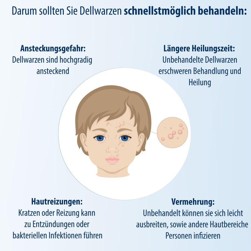 [Australia] - Evolsin® Molar Wart Remedy I For Adults & Children Ages 2+ I Gentle & Effective Molar Wart Treatment 