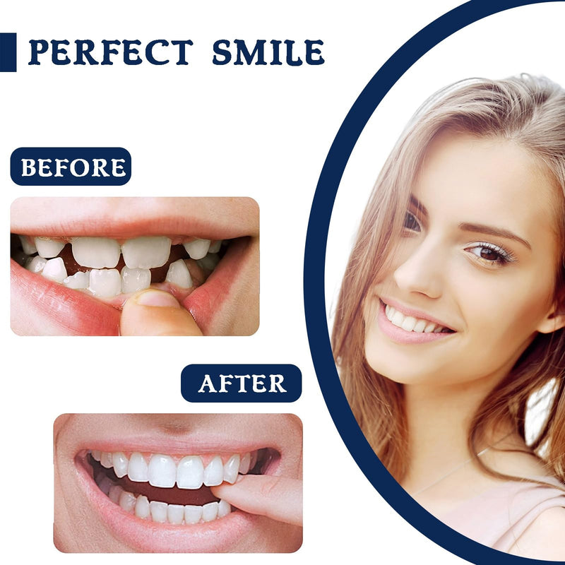 [Australia] - 2 Pairs, Top and Bottom, Adjustable Temporarily, Beautiful Smile 