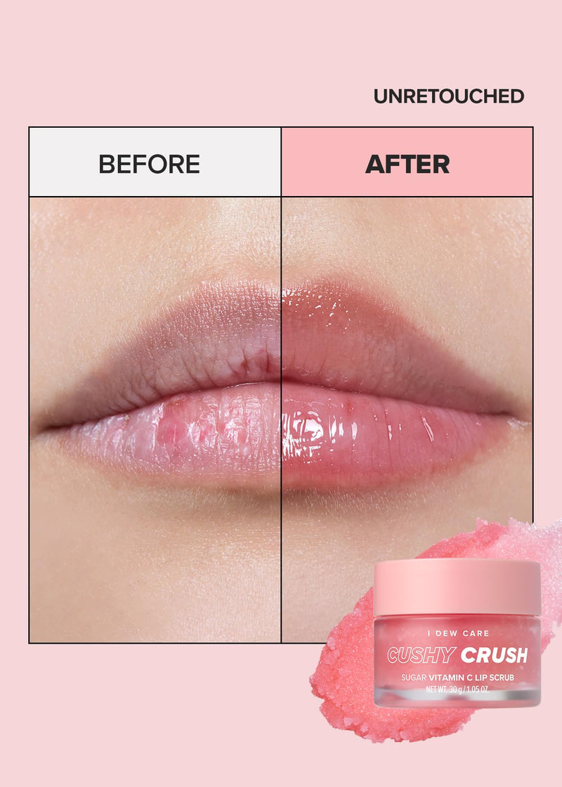 [Australia] - I DEW CARE Lip Scrub - Cushy Crush | Sugar Vitamin C, Lip Care, Lip Scrubber Exfoliator, Lip Exfoliator Scrub, Lip Care Products, for Dark, Dry and Chapped Lips, Vegan, 1.05 oz 