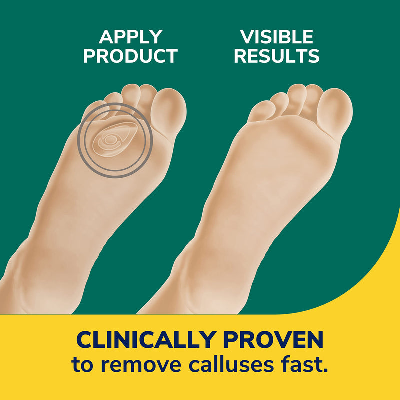 [Australia] - Dr. Scholl's CALLUS REMOVER Seal & Heal Bandage with Hydrogel Technology, 4ct // Removes Calluses Fast And Provides Cushioning Protection Against Shoe Pressure And Friction For All-Day Pain Relief 