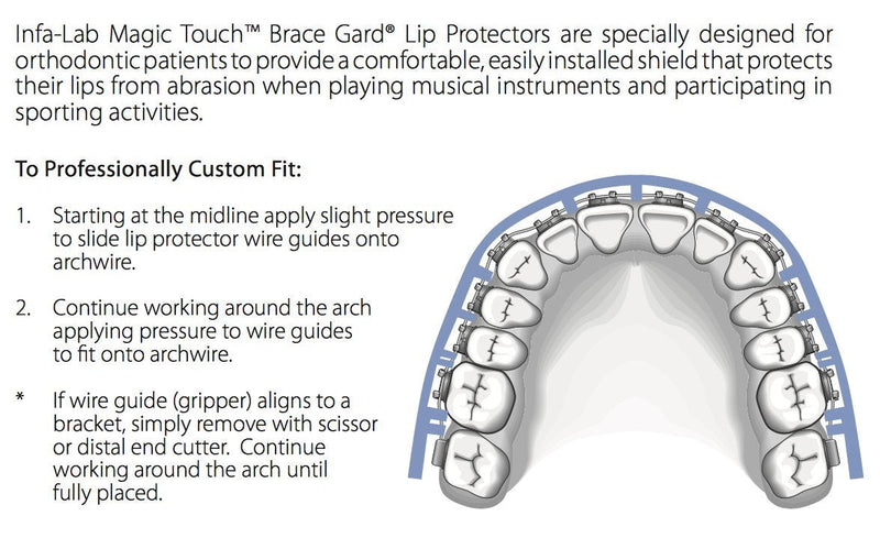 [Australia] - Orthodontic Braces Lip Guard Protector Shield (1 Set - Upper - Lower Teeth) with Instructions by AdentalZ 