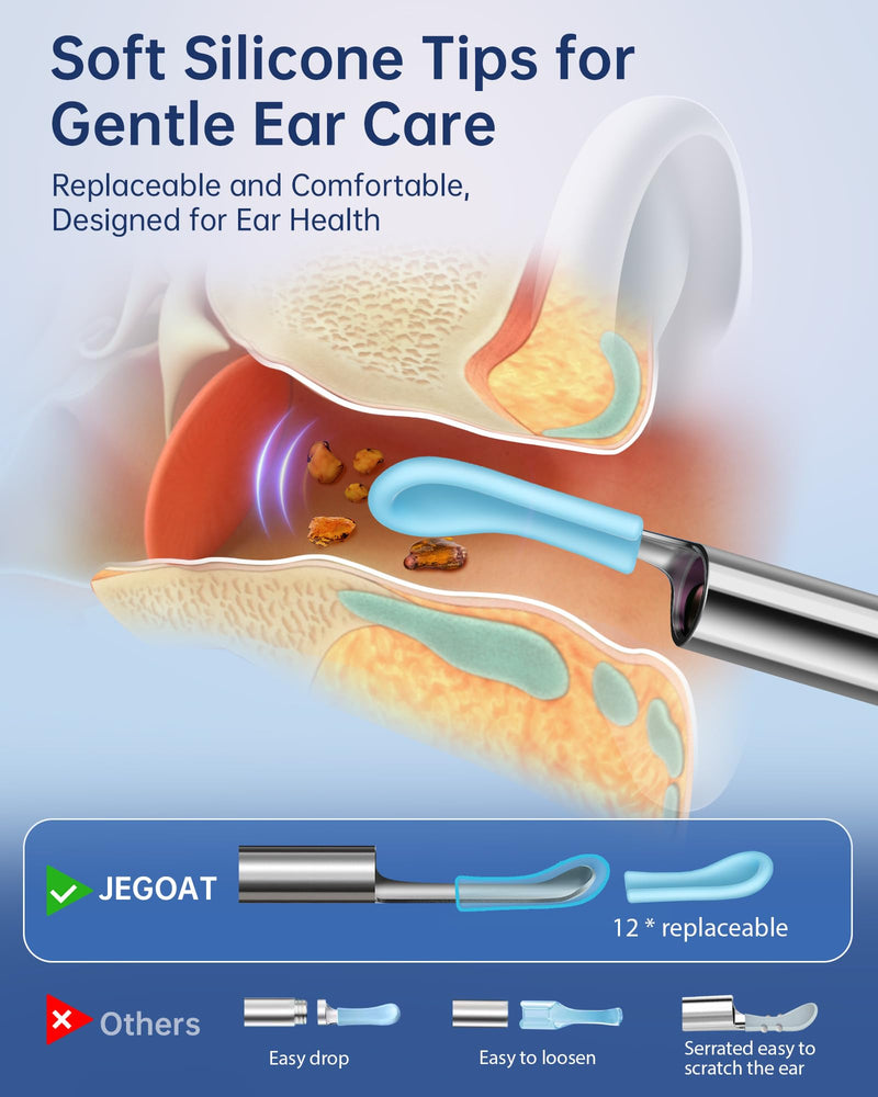 [Australia] - Ear Wax Removal - Ear Cleaner with Camera 1296P HD Ear Scope 6 LED Lights and 10 Pcs Ear Spoon - Earwax Remover Tool Jet Black 