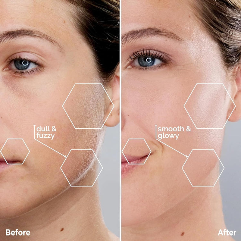 [Australia] - Facial Hair Removal for Women - Painless Facial Hair Remover - Electric Hair Removal Device for Face Lips Peach Fuzz with Light (Rose Gold) Rose Gold 
