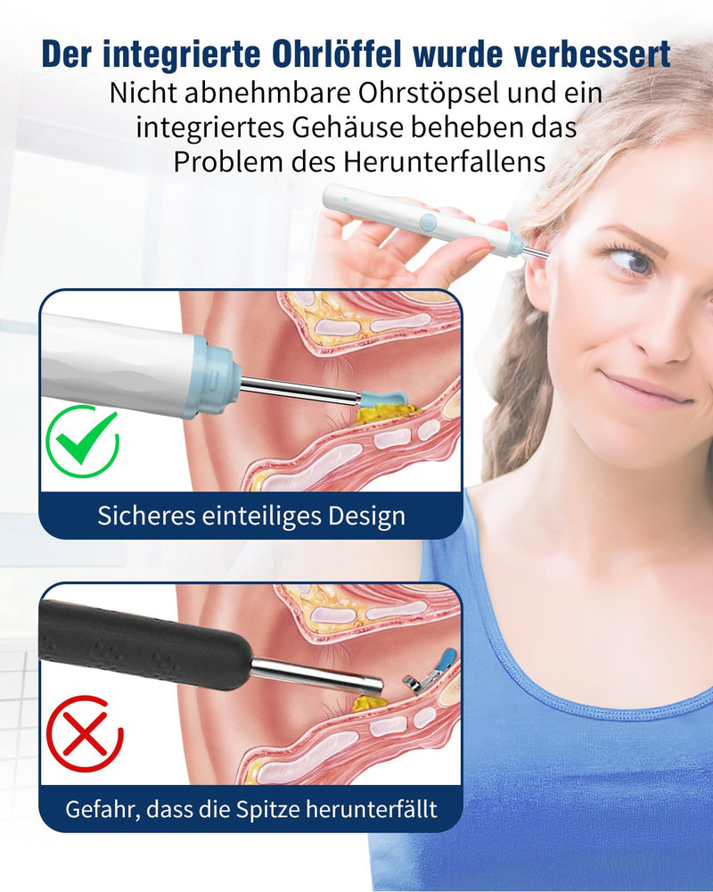 [Australia] - Kekoy Earwax Remover Otoscope with Light, 1296P Ear Cleaner with Camera, WiFi Ear Cleaner with Camera, Rechargeable Ear Cleaner, Ear Cleaner for Adults and Children (White Blue) White Blue 