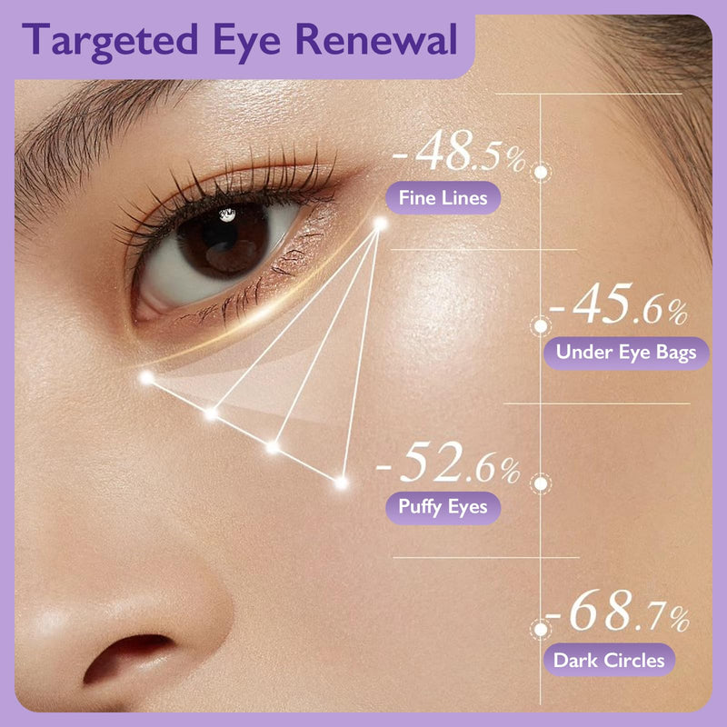 Under Eye Cream for Dark Circles & Puffiness, Retinol & Caffeine, 0.7 Fl Oz | Niacinamide and vitamin E support smoother, hydrated-looking skin with a lightweight, fast-absorbing texture for daily care