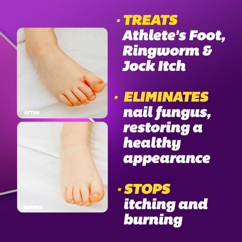 Silka Max Strength Antifungal Liquid & Athlete's Foot Cream Set, 2 Count | Powerfull Relief for Athlete's Foot, Ringworm & Jock Itch; Helps Relieve Itching & Burning