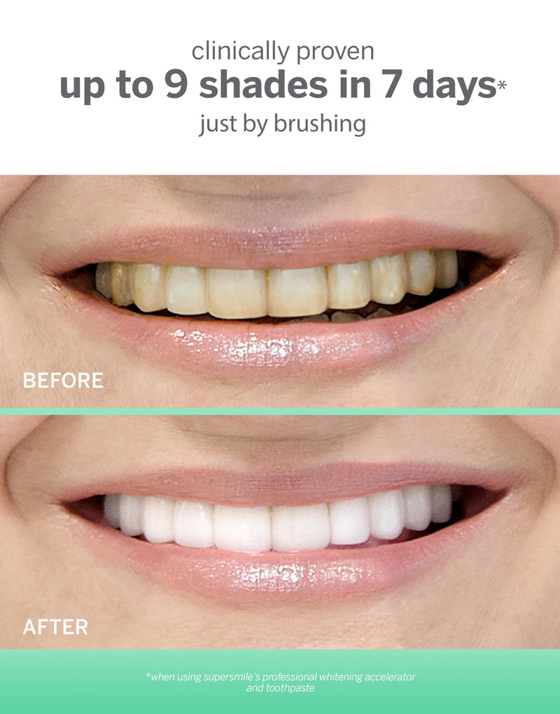 Supersmile Extra White Triple Mint Whitening Toothpaste – Professional Formula for Visibly Whiter Teeth – Whitens Up to 9 Shades, 7 oz