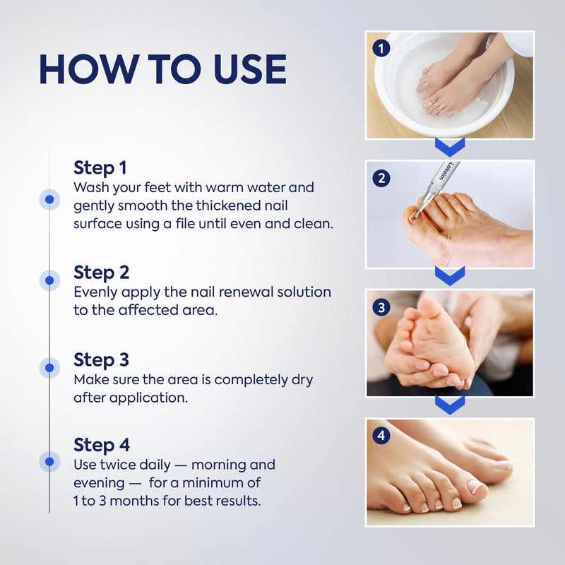 Toenail Fungus Treatment Extra Strength: 25% Undecylenic Acid & Tea Tree Oil - Repairs Yellow Thick Brittle Toe and Fingernails - 3 Pens with 5 Nail Files 0.14 Fl Oz (Pack of 3)
