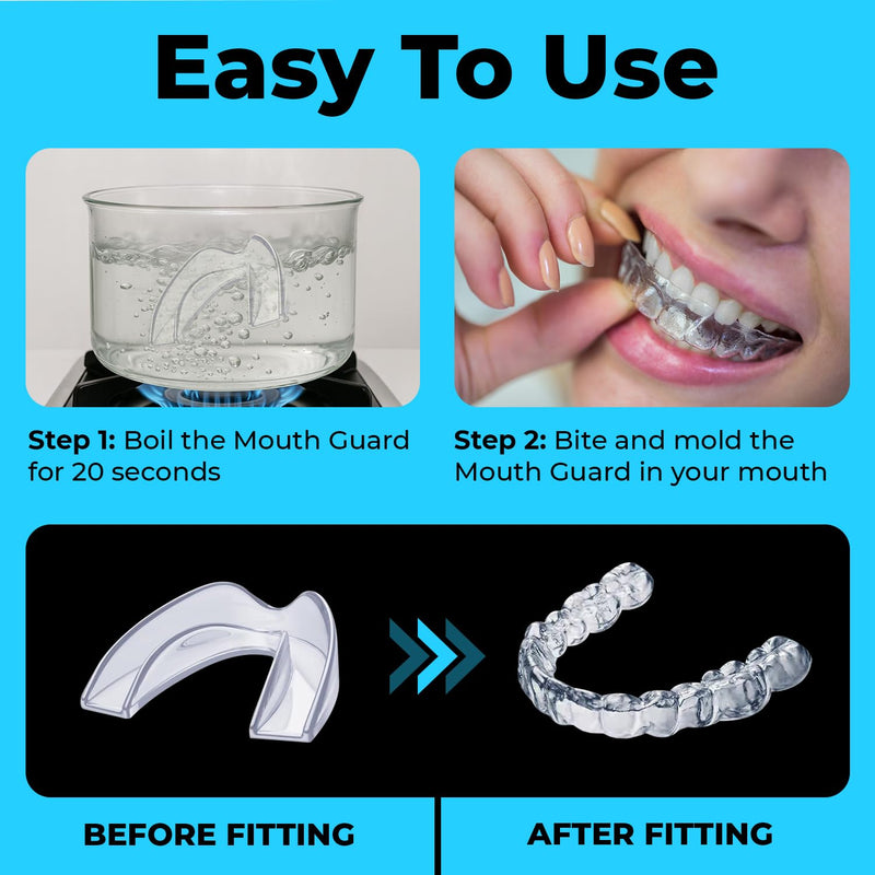 [Australia] - Mouth Guard for Grinding Teeth at Night | Dental Night Guard for Clenching & Better Sleep | 4 Moldable Mouthguards with 12 Cleansing Tablets 