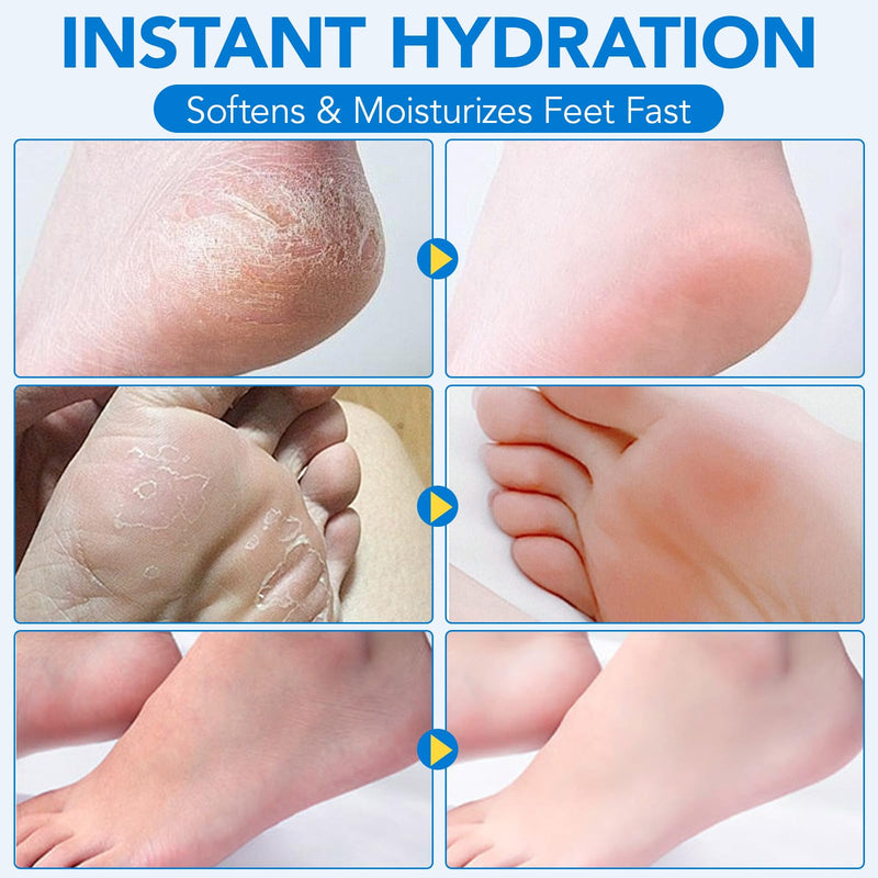 Uruses 3Pack Urea Cream 60% plus Salicylic Acid 2% Urea Foot Care Stick,Foot Cream for Foot Callus Remover, Feet Moisturizer Stick for Dry Cracked Heels, Hands, Knees,Hydrating Heel Balm, Easy To Use