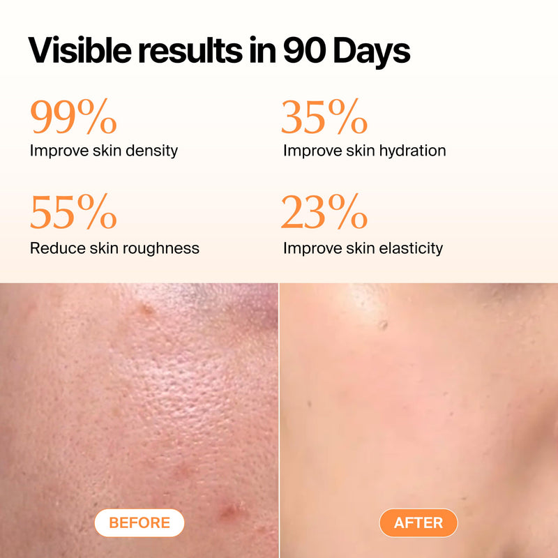 Ownist Triple Collagen Liquid Packets On-The-Go - Peptides with Hydrolyzed Marine Collagen, Elastin, Hyaluronic Acid and Vitamin for Healthy Skin - Orange Flavor - 14 Individual Stick Packs