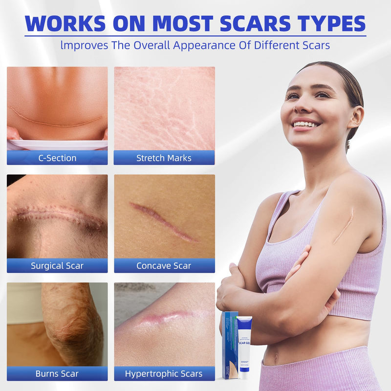 [Australia] - Scar ointment to reduce scar visibility, scar gel for old and new scars, scar cream for children & adults for burns to reduce scars (45g) odorless 