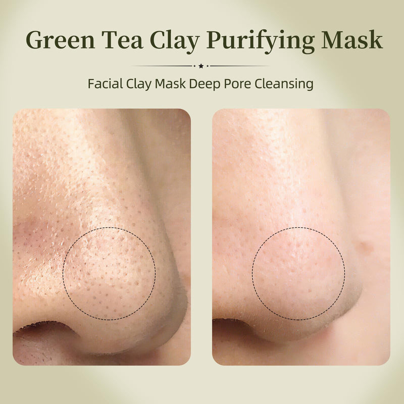 Green Tea Clay Mask, Clay Masks Deep Pore Cleansing, Wash-Off Mask with Hyaluronic Acid, Zinc PCA, Allantoin & Vitamin E, Hydrating Skincare for Oily Skin, Blackheads 3.53 fl.oz