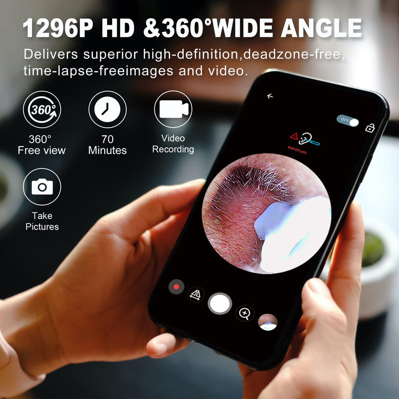 [Australia] - Ear Wax Removal, Ear Cleaner with Camera and Light, Ear Wax Removal Kit with 1296P Otoscope, Ear Cleaning Tool with 6 Ear Spoon, Ear Camera for iPhone & Android Phones,Black Black 