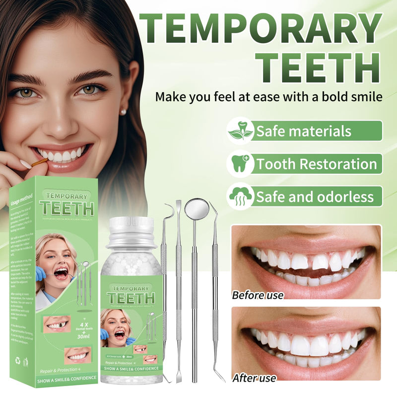 Tooth Repair Kit, Moldable Tooth Filling Repair Kit, Fake Teeth DIY at Home, Fixing Missing & Broken Tooth Replacements, with 4 Dental Tools-C01