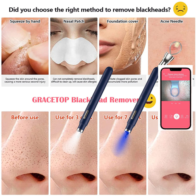 Blackhead Remover with Camera, WiFi Visual Blackhead Remover Tools with White/Blue Lights for iPhone, Android Phones Women Gift Blackhead Remover - Navy Blue