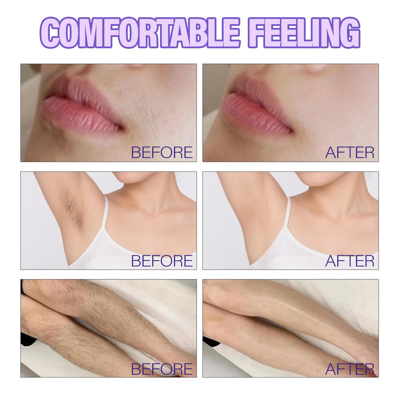 [Australia] - Hair Removal Cream for Women - All In One Body & FaceDepilatory Cream - Fast Acting Formula for Smooth SkinGentle on Sensitive Skin 1 Count (Pack of 1) 