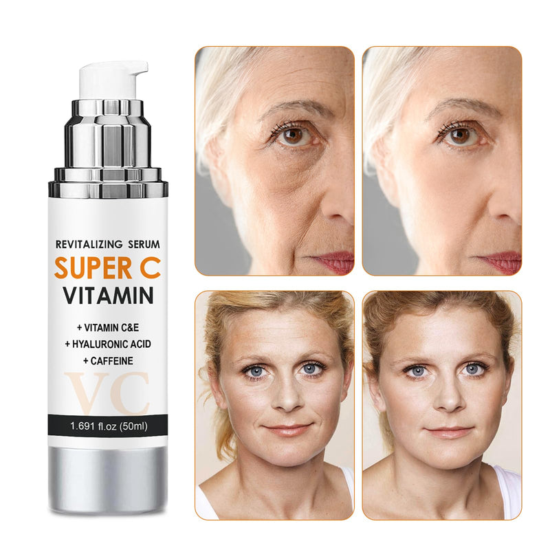 Vitamin C Serum for Face with Hyaluronic Acid & Vitamin E - Super C Revitalizing Face Serum for Anti-Aging - Reduces Wrinkles & Dullness for Radiant Skin - 1.69 fl.oz