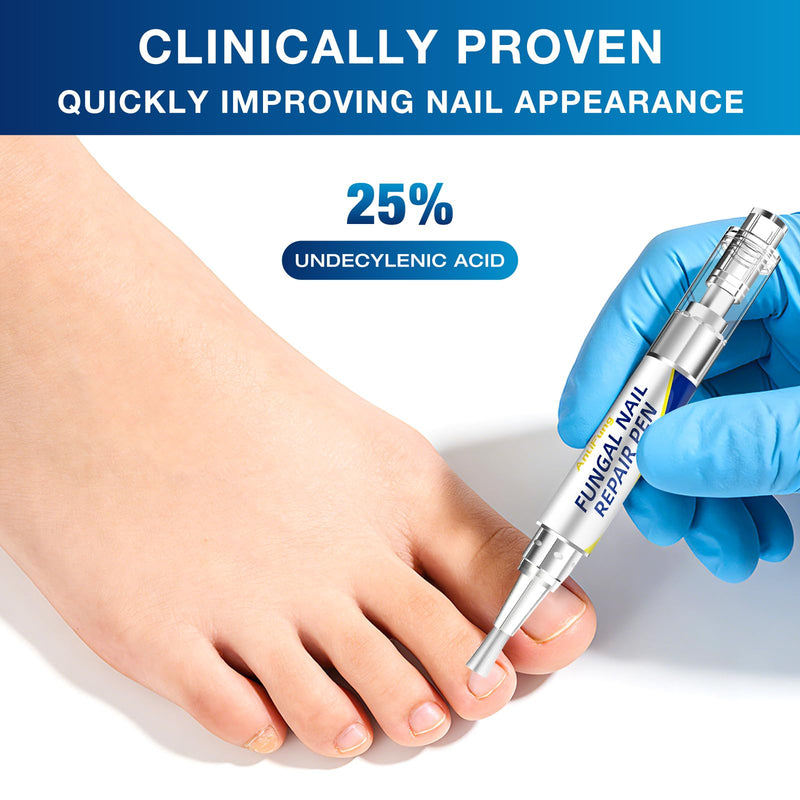 Toenail Fungus Treatment Extra Strength - AntiFung Pen - Maximum OTC with 25% Undecylenic Acid - for Damaged Nails, Ingrown Nails & Discoloration - 3-Pack Applicator Pen 1 Fl Oz (Pack of 3)