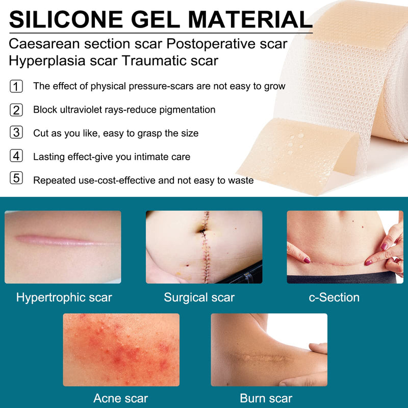 [Australia] - Silicone Scar Plaster, Professional for C-Section Scars, Surgery, Burns, Keloid, Acne and More, Drug Free, Silicone Scar Roller(4CMx300CM) 4CMx300CM 