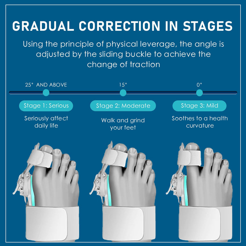 [Australia] - Baby Molove Hallux Valgus Correction, Adjustable Button Hallux Valgus Splint Bunion, Elastic Bunion Corrector, Hallux Valgus Bunion Correction White 