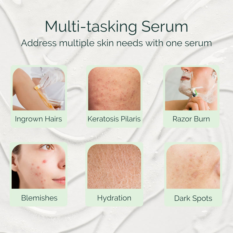 [Australia] - Serious Serum Exfoliating Ingrown Hair Serum – Glycolic, Lactic & Salicylic Acid Formula for Smooth Skin – Razor Bumps, Ingrown Hairs & Razor Burn – Hydrating Formula for Post-Shave & Waxing Care 