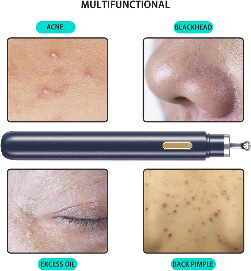 Blackhead Remover Tools with Camera Visible Pore Cleaner Waterproof Acne Comedone Whitehead Extractor Kit for iPhone/Android