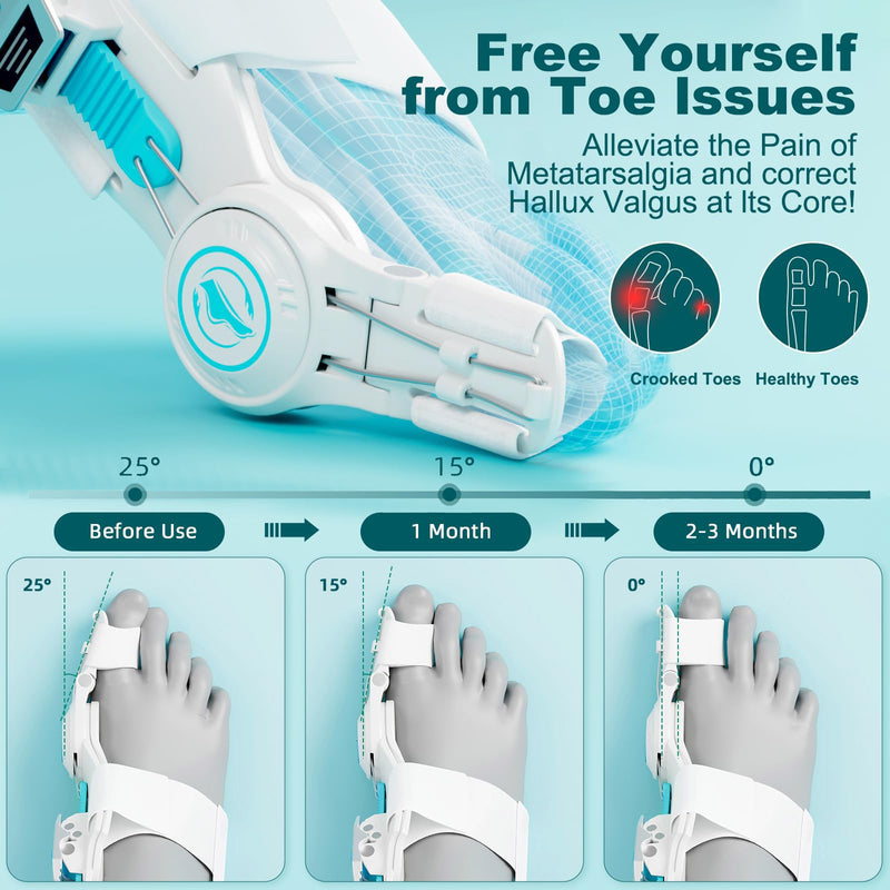 Upgraded Bunion Corrector for Women & Men, Orthopedic Bunions Correction with Non Slip Big Toe Straighteners, Adjustable Bunion Splint Suitable for Day/Night Feet Bunion Relief (2PCS)