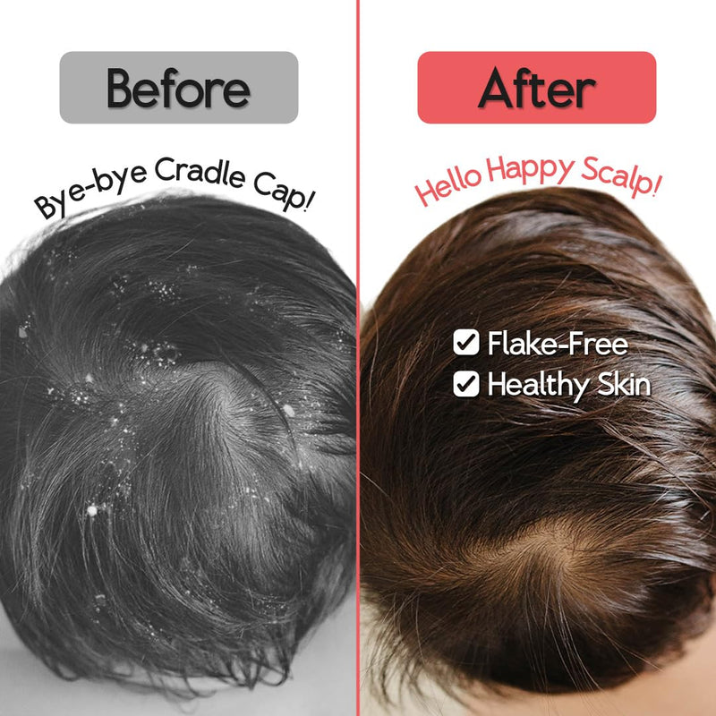 [Australia] - SplashEZ Cradle Cap Brush for Babies | Soothing Newborn Head Massager | Food-Grade Soft Silicone Baby Bath Brush & Scalp Scrubber | Infant Cradle Cap Comb - Organic Shape & Ladybug Design, 2-Pack 