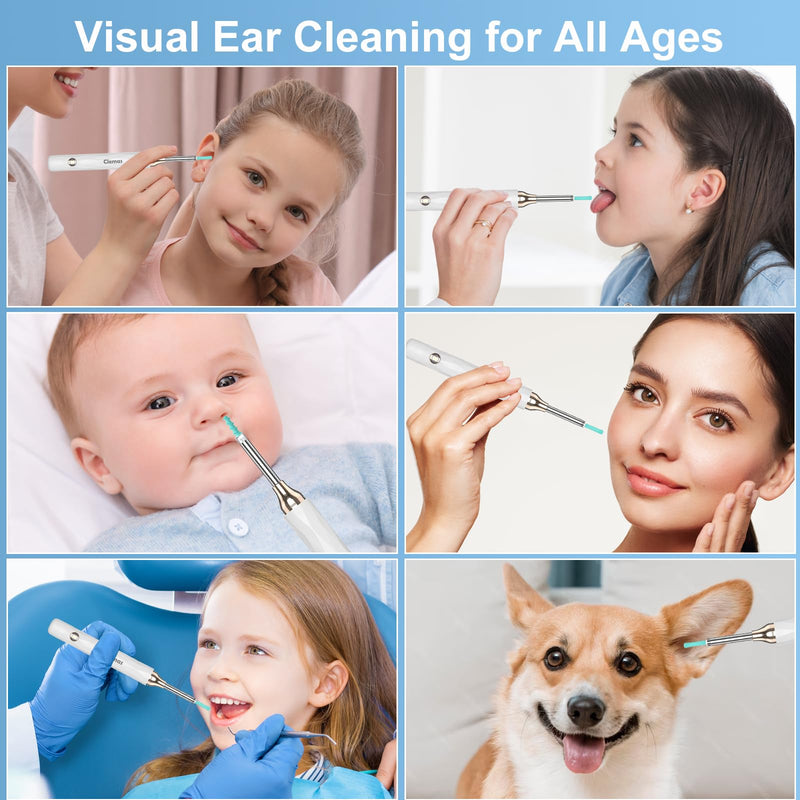 [Australia] - Earwax Remover Otoscope, 1296P HD WiFi Ear Cleaner Camera, IP67 Waterproof, 6 LED Lights, 3.5mm Lens, 360° Wide Angle, Compatible with iPad and Android 