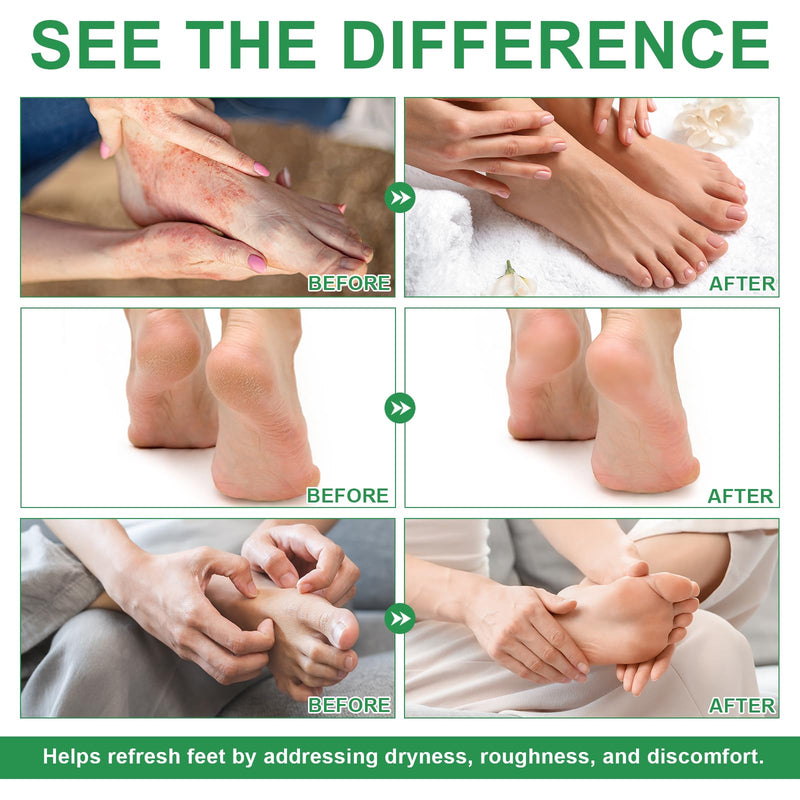 [Australia] - Foot Tea Tree Oil Spray - Odor Control & Itch Relief with Tea Tree Oil | 120ml (4oz) | Natural Foot Deodorizer for Fresh, Clean Feet. 