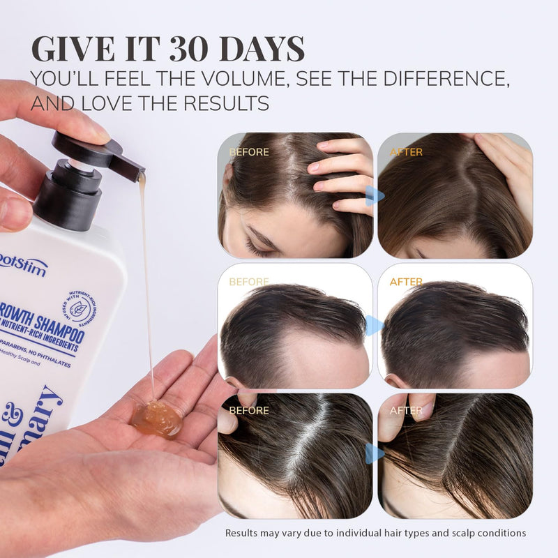 Biotin & Rosemary Shampoo for Hair Growth: Hair Loss Shampoo for Thinning Hair Infused with Natural Nutrient Rich Ingredients for Hair thickening Sulfate Free 10 fl oz Clear 10 Fl Oz (Pack of 1)