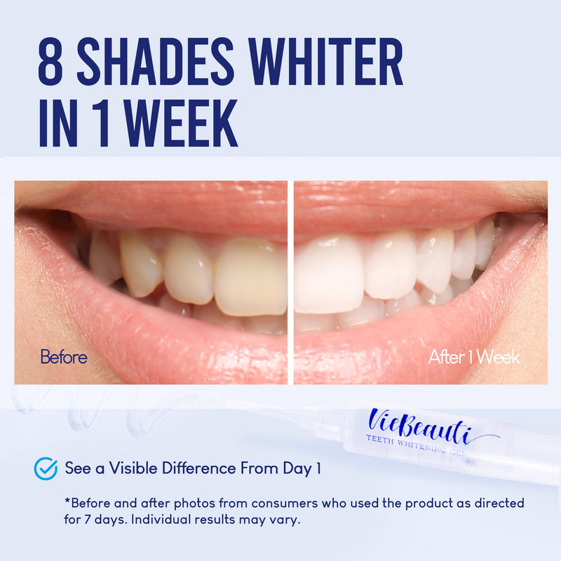 VieBeauti Teeth Whitening Kit with LED Light for Sensitive Teeth, 35% Carbamide Peroxide, Remineralizing Gel for Fast Results Cool Mint
