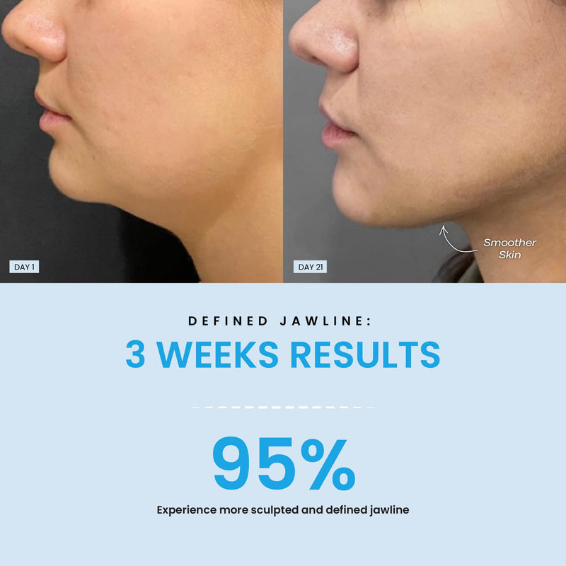 Red Light Therapy Face & Neck Massager – LiftLab 3-in-1 LED Sculptor with Blue & Green Modes – Jawline & Double Chin Tightening, Wrinkle & Spot Care -Improved Battery