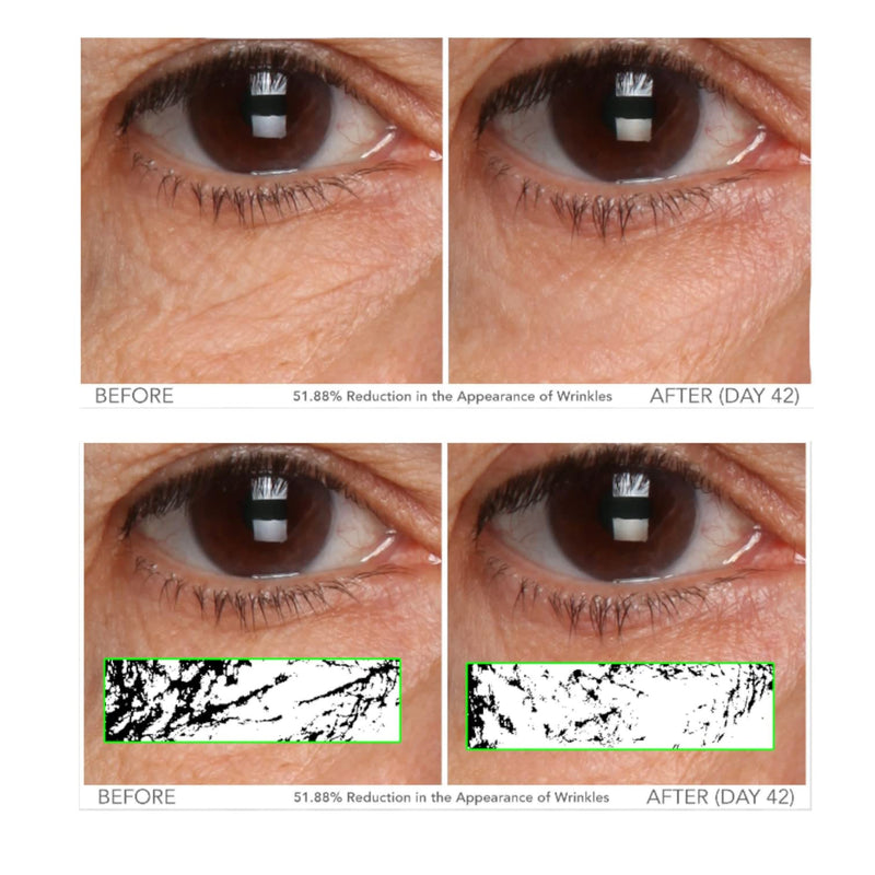 Serious Skincare Vitamin C Brightening Under Eye Gel Serum Treatment 0.5 oz | Hyaluronic Acid, Collagen, Fine Lines, Crow's Feet, Wrinkles, Dark Circles, Hydrating, Soothing, C3 Plasma C Ester