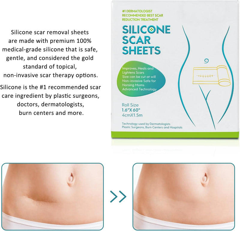 [Australia] - Medical Grade Silicone Scar Sheets, Silicone Scar Tape (1.6”x 60” Roll-1.5M), Professional Scar Removal Treatment, Reusable Silicone Scar Strip for Keloid, C-Section, Surgery, Burns, Acne Etc Brown 