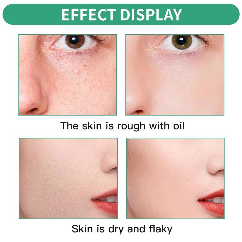 [Australia] - YANINEE 2 pieces 50 ml Needle Shot 100 300 serum with Centella complex 