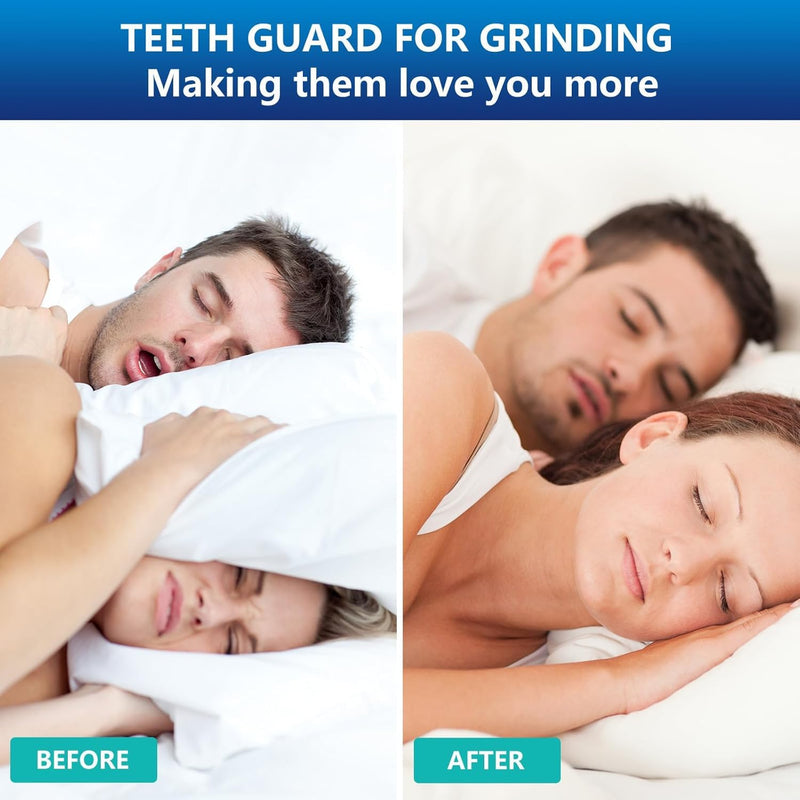 Mouth Guard for Grinding Teeth at Night - Dental Anti-Teeth Clenching Night Guards, Sleep Mouth Guard for Bruxism, Clenching Teeth Protector for Adults 2 Sizes with One Travel Cases