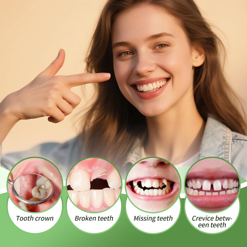 Tooth Repair kit for Filling The Missing Broken Tooth and Gaps-Moldable Fake Teeth and Thermal Beads Replacement Kit-White-A04