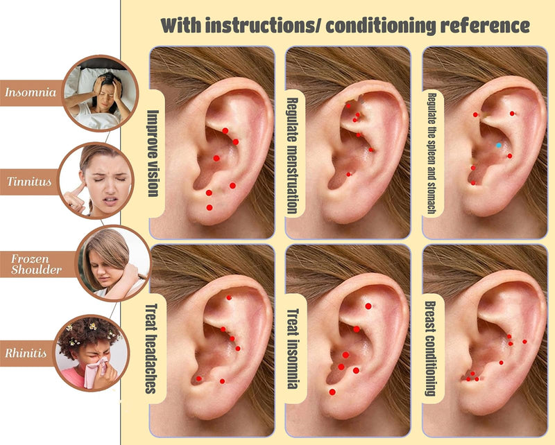 [Australia] - Ear Seeds Acupuncture Kit - 100 Pieces - Acupressure with Ears Seed, with Bonus Free Chart and Brass Acupressure Probe - for Balance & Wellness (Gold-100pcs) Gold-100pcs 