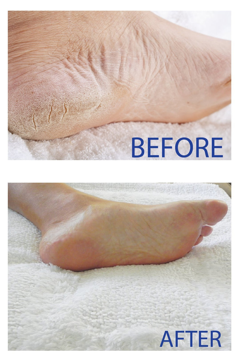 [Australia] - Smith's Amish Foot Cream (4 oz.) Deep Soothing Herbal Cream for Intense Foot and Leg Discomfort including Burning, Cramping and Restlessness Sensations 