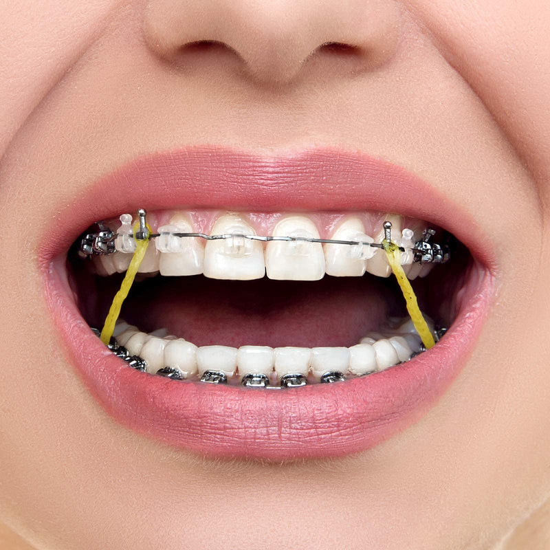 [Australia] - JMU Orthodontic Elastics 5/16 Medium, 500 pack Latex Intraoral Elastic Bands Latex Dental Rubber Bands Made in USA, Amber 
